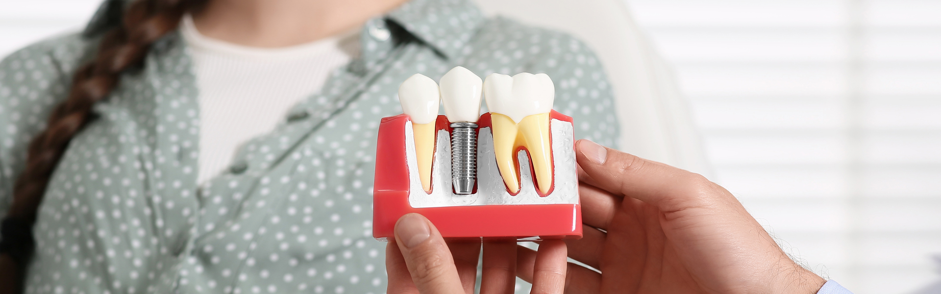 Dental Implants Restorations