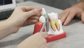 The Complete Process of Dental Implant Restorations in Grand Prairie, TX